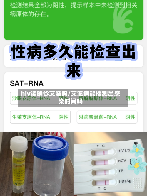 hiv能确诊艾滋吗/艾滋病能检测出感染时间吗