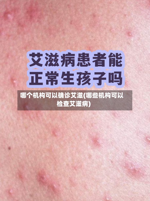 哪个机构可以确诊艾滋(哪些机构可以检查艾滋病)