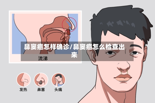 鼻窦癌怎样确诊/鼻窦癌怎么检查出来