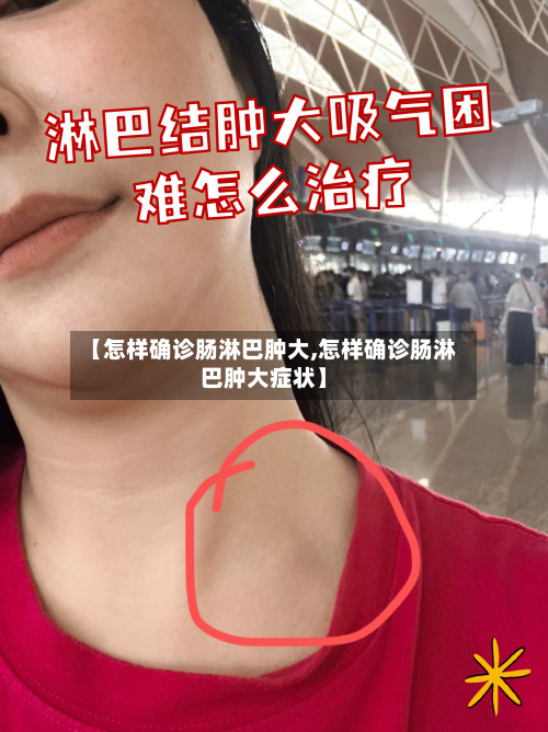 【怎样确诊肠淋巴肿大,怎样确诊肠淋巴肿大症状】-第2张图片