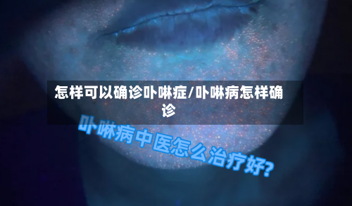 怎样可以确诊卟啉症/卟啉病怎样确诊