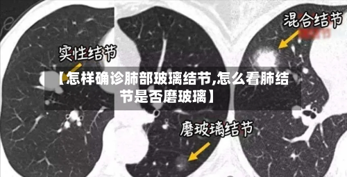 【怎样确诊肺部玻璃结节,怎么看肺结节是否磨玻璃】