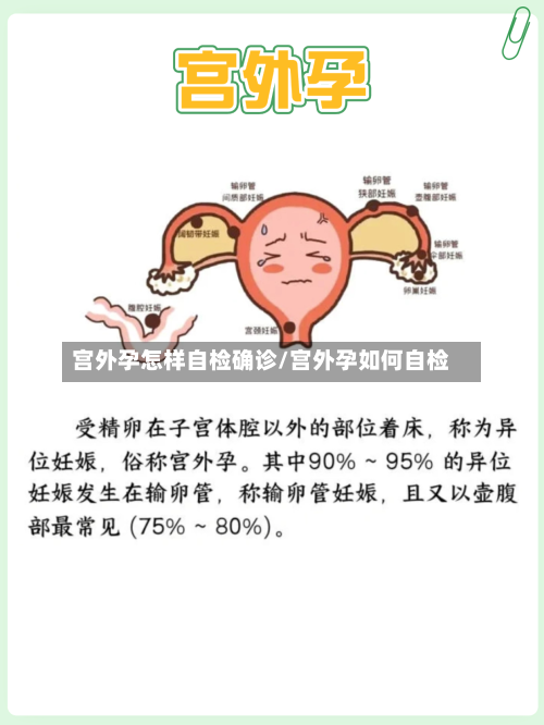 宫外孕怎样自检确诊/宫外孕如何自检