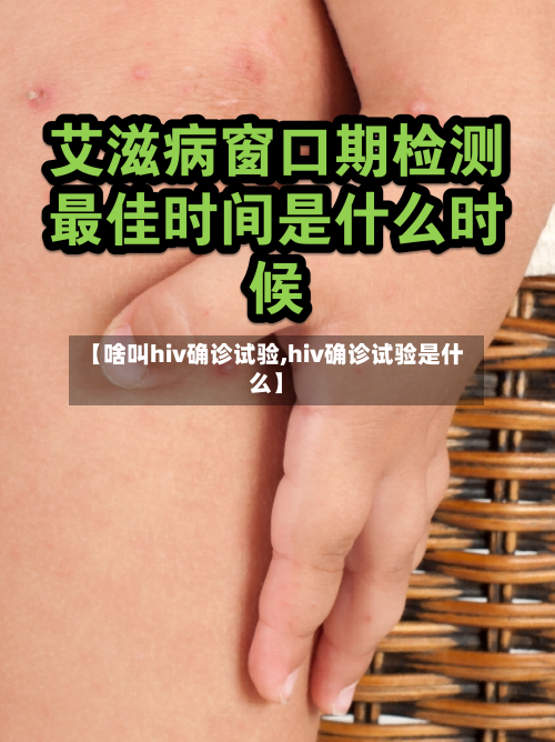 【啥叫hiv确诊试验,hiv确诊试验是什么】-第2张图片