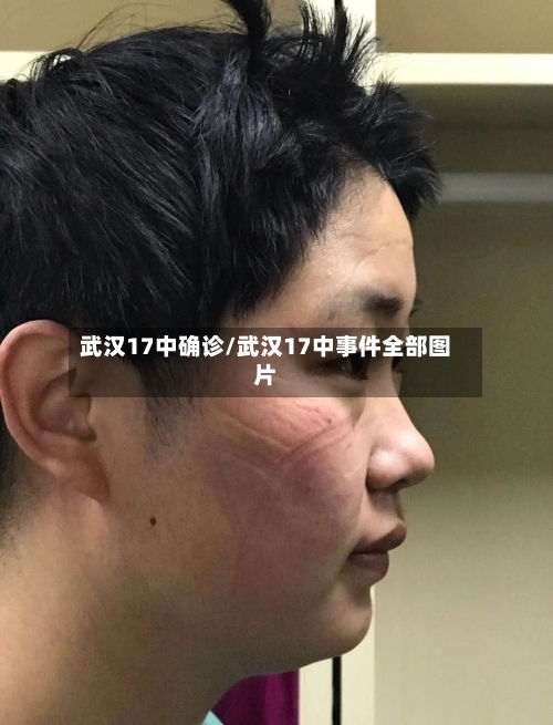武汉17中确诊/武汉17中事件全部图片