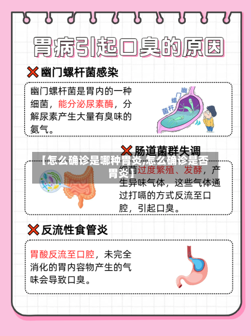 【怎么确诊是哪种胃炎,怎么确诊是否胃炎】