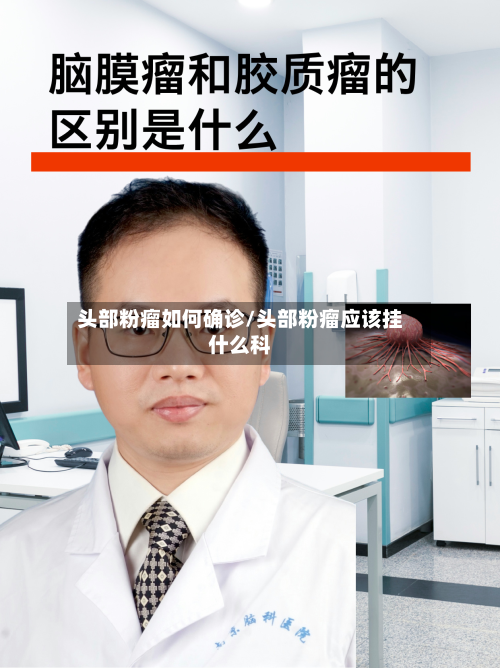 头部粉瘤如何确诊/头部粉瘤应该挂什么科