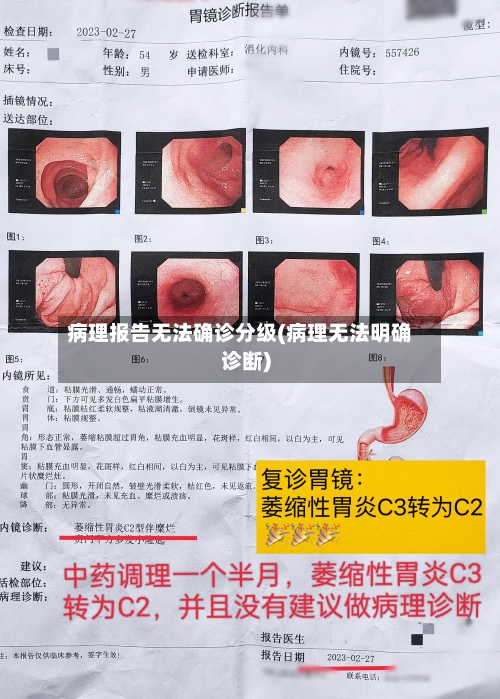 病理报告无法确诊分级(病理无法明确诊断)-第3张图片