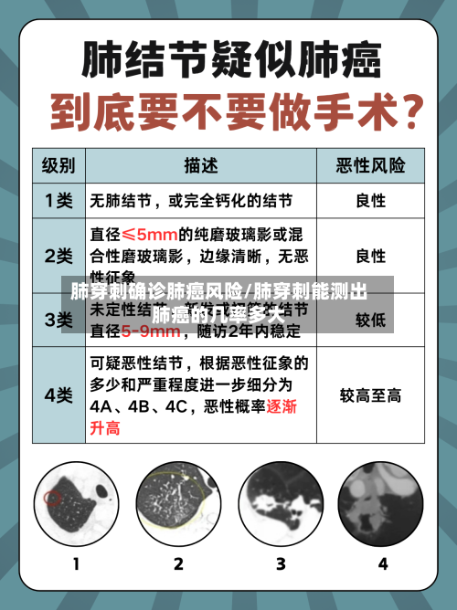 肺穿刺确诊肺癌风险/肺穿刺能测出肺癌的几率多大-第2张图片