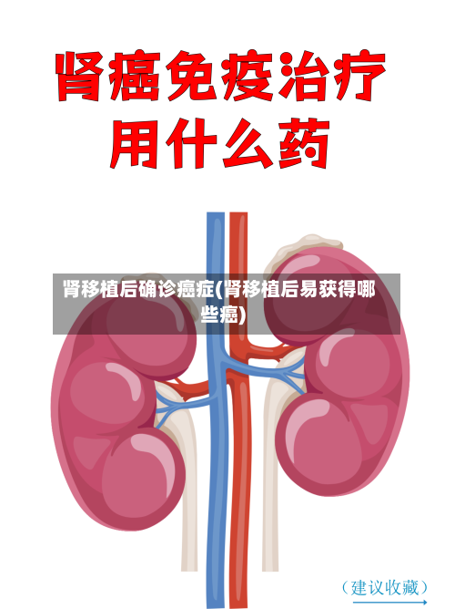 肾移植后确诊癌症(肾移植后易获得哪些癌)