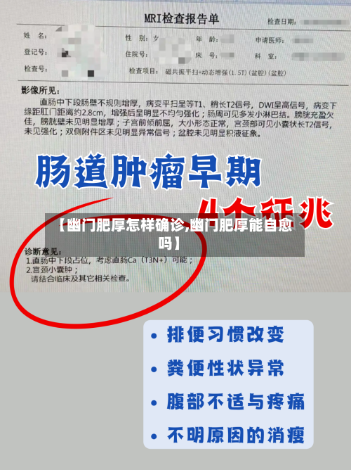 【幽门肥厚怎样确诊,幽门肥厚能自愈吗】