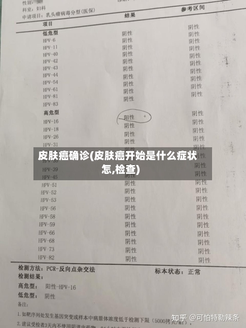 皮肤癌确诊(皮肤癌开始是什么症状怎,检查)-第3张图片