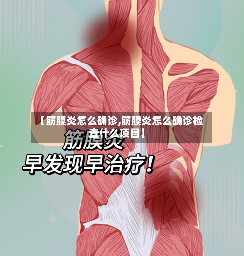 【筋膜炎怎么确诊,筋膜炎怎么确诊检查什么项目】-第3张图片
