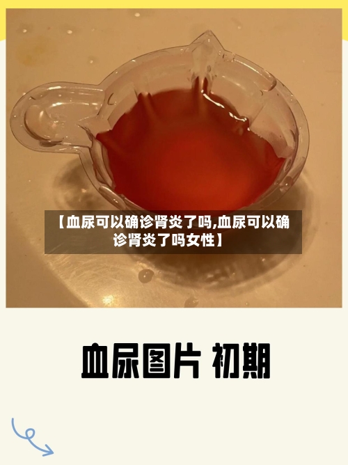 【血尿可以确诊肾炎了吗,血尿可以确诊肾炎了吗女性】