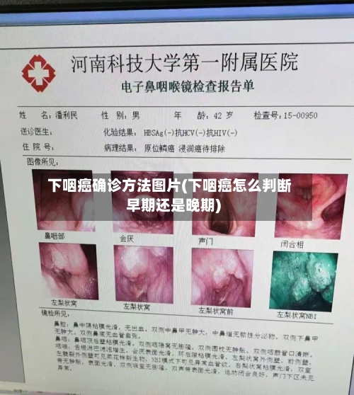 下咽癌确诊方法图片(下咽癌怎么判断早期还是晚期)-第2张图片