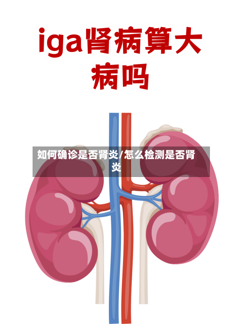 如何确诊是否肾炎/怎么检测是否肾炎