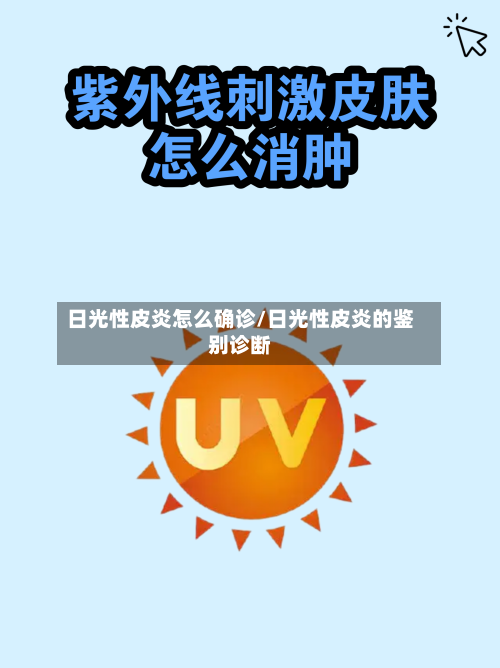 日光性皮炎怎么确诊/日光性皮炎的鉴别诊断-第3张图片