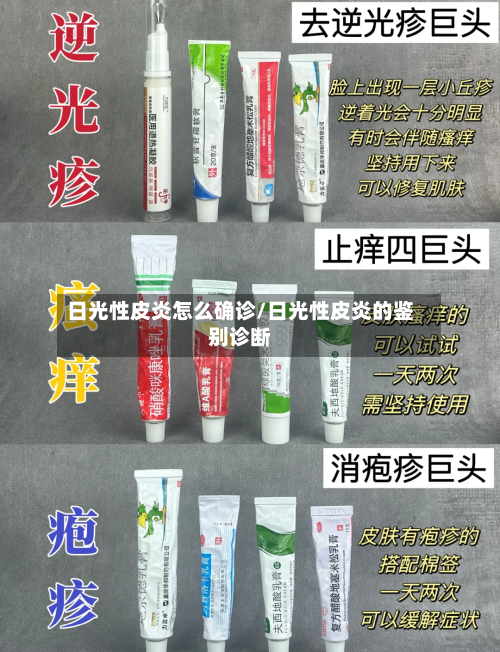 日光性皮炎怎么确诊/日光性皮炎的鉴别诊断-第2张图片