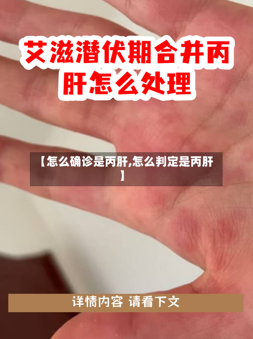 【怎么确诊是丙肝,怎么判定是丙肝】