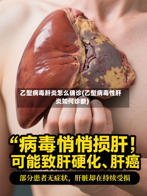乙型病毒肝炎怎么确诊(乙型病毒性肝炎如何诊断)-第2张图片