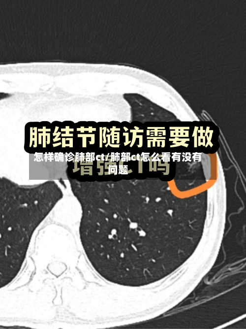 怎样确诊肺部ct/肺部ct怎么看有没有问题