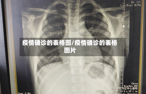 疫情确诊的表格图/疫情确诊的表格图片-第2张图片