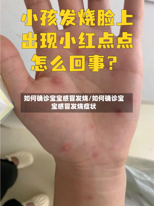 如何确诊宝宝感冒发烧/如何确诊宝宝感冒发烧症状-第2张图片