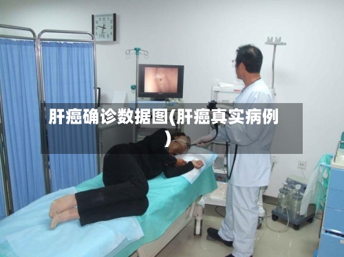 肝癌确诊数据图(肝癌真实病例)