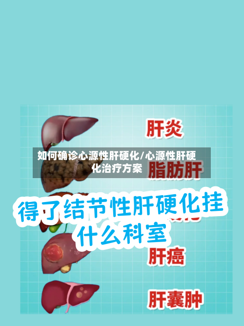 如何确诊心源性肝硬化/心源性肝硬化治疗方案-第2张图片