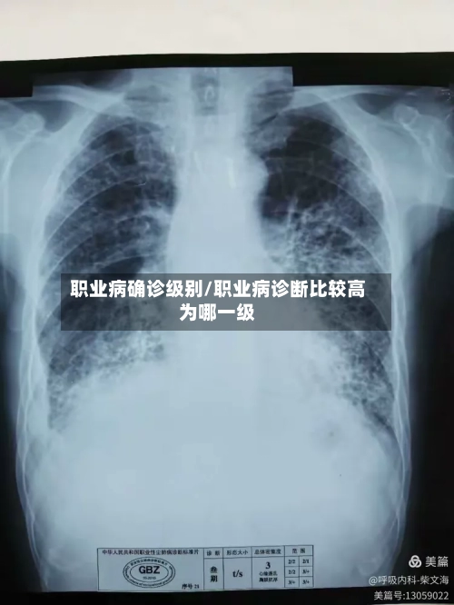 职业病确诊级别/职业病诊断比较高为哪一级-第2张图片