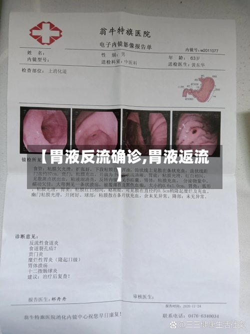 【胃液反流确诊,胃液返流】-第3张图片