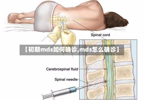 【初期mds如何确诊,mds怎么确诊】-第3张图片