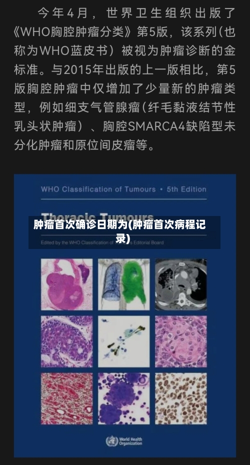 肿瘤首次确诊日期为(肿瘤首次病程记录)-第2张图片