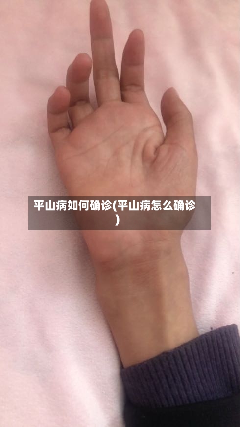 平山病如何确诊(平山病怎么确诊)