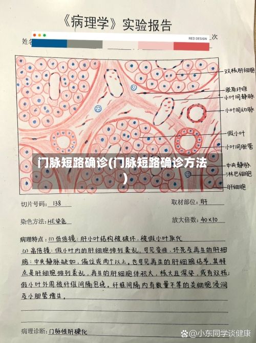 门脉短路确诊(门脉短路确诊方法)-第3张图片
