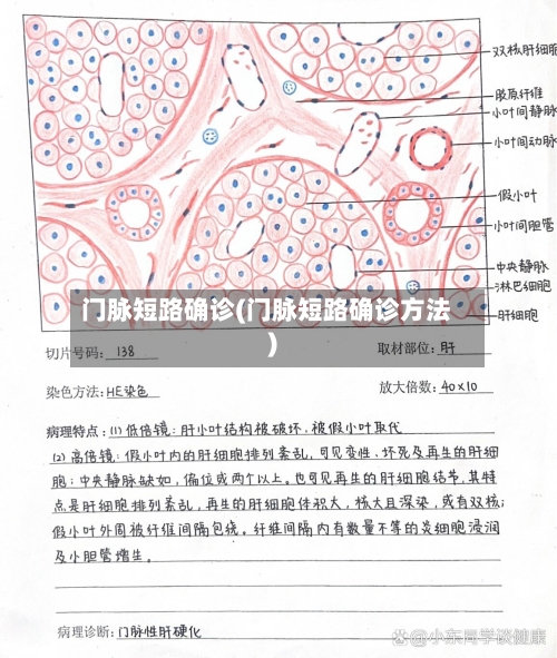 门脉短路确诊(门脉短路确诊方法)-第2张图片