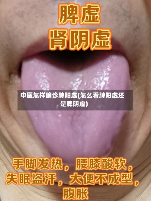 中医怎样确诊脾阳虚(怎么看脾阳虚还是脾阴虚)-第3张图片