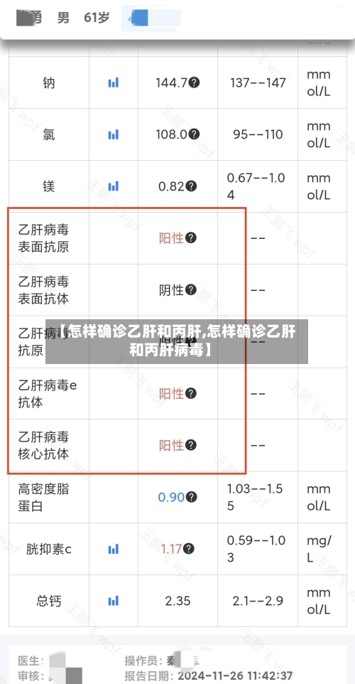 【怎样确诊乙肝和丙肝,怎样确诊乙肝和丙肝病毒】-第3张图片