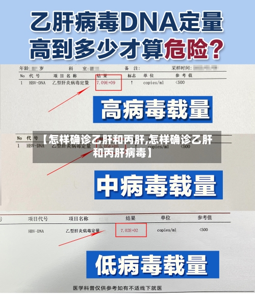 【怎样确诊乙肝和丙肝,怎样确诊乙肝和丙肝病毒】-第2张图片