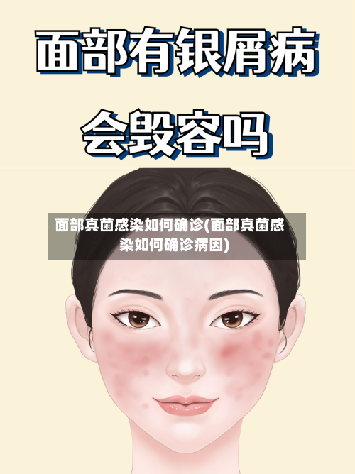 面部真菌感染如何确诊(面部真菌感染如何确诊病因)