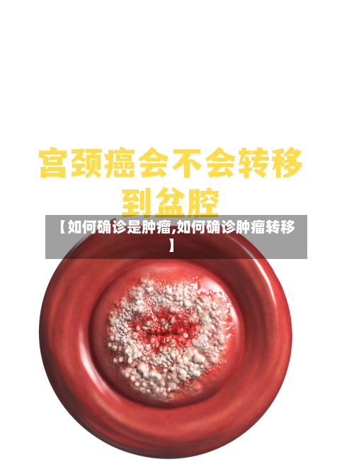 【如何确诊是肿瘤,如何确诊肿瘤转移】-第2张图片