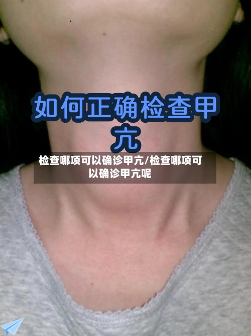 检查哪项可以确诊甲亢/检查哪项可以确诊甲亢呢