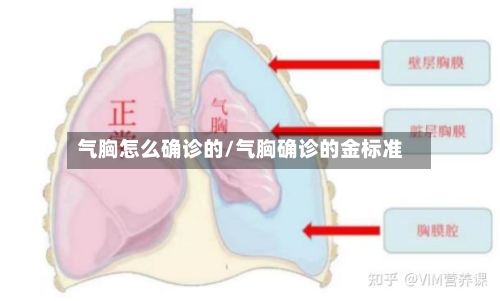 气胸怎么确诊的/气胸确诊的金标准