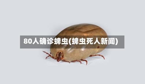 80人确诊蜱虫(蜱虫死人新闻)-第3张图片