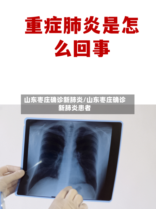 山东枣庄确诊新肺炎/山东枣庄确诊新肺炎患者-第3张图片
