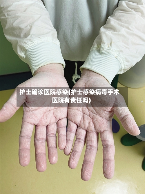 护士确诊医院感染(护士感染病毒手术医院有责任吗)-第2张图片