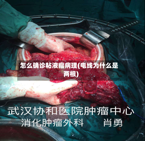 怎么确诊粘液瘤病理(电线为什么是两根)