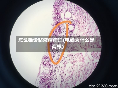 怎么确诊粘液瘤病理(电线为什么是两根)-第2张图片