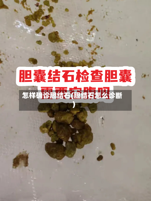 怎样确诊胆结石(胆结石怎么诊断)-第3张图片
