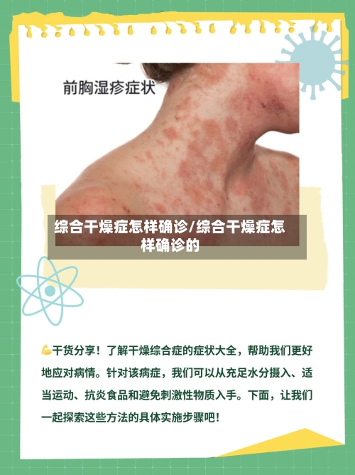 综合干燥症怎样确诊/综合干燥症怎样确诊的